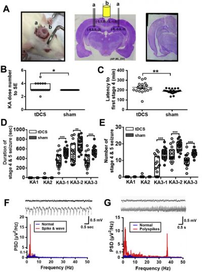 Transcranial Direct Current Stimulation Alleviates Seizure Severity in Kainic Acid-Induced Status Epilepticus Rats