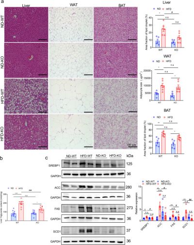 Deficiency of ADAR2 ameliorates metabolic-associated fatty liver disease via AMPK signaling pathways in obese mice