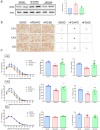 Reduction of Dietary Fat Rescues High-Fat Diet-Induced Depressive Phenotypes and the Associated Hippocampal Astrocytic Deficits in Mice