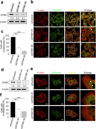 STIM1-dependent Ca2+ signaling regulates podosome formation to facilitate cancer cell invasion.
