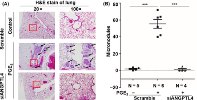 Epidermal Growth Factor-Induced COX-2 Regulates Metastasis of Head and Neck Squamous Cell Carcinoma Through Upregulation of Angiopoietin-Like 4