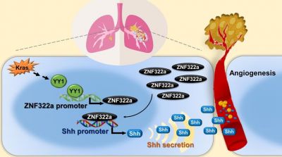 Dysregulated Kras/YY1/ZNF322A/Shh axis trans-criptional enhances neo-angiogenesis to promote lung cancer progression