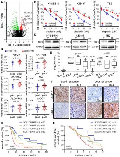 Dysregulation of SOX17/NRF2 axis confers chemoradiotherapy resistance and emerges as a novel therapeutic target in esophageal squamous cell carcinoma